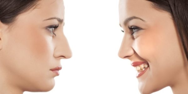 Rinoplastia: A Plástica do Nariz, Veja os Riscos e Valor da Cirurgia