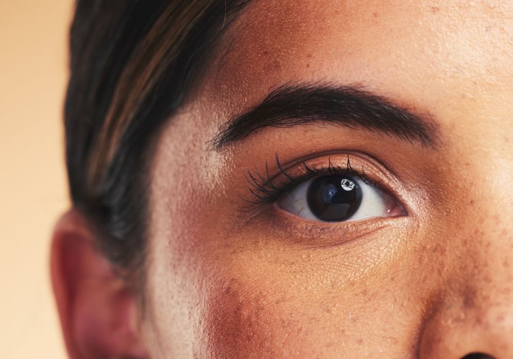 Melhor Sabonete para Melasma Os Melhores de 2025 Melhor Sabonete para Melasma Os Melhores de 2025